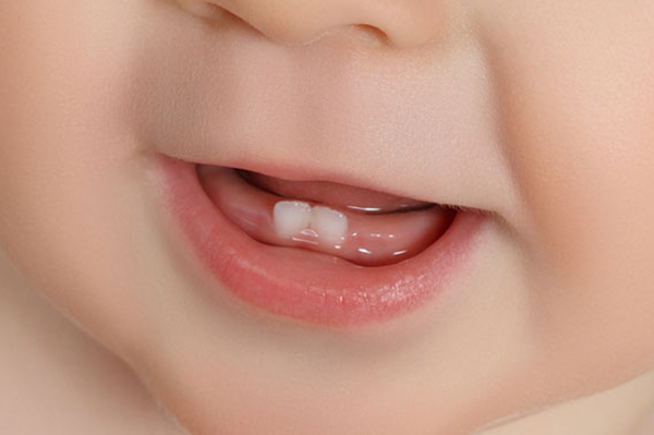 از دندان شیری بیشتر بدانید!
